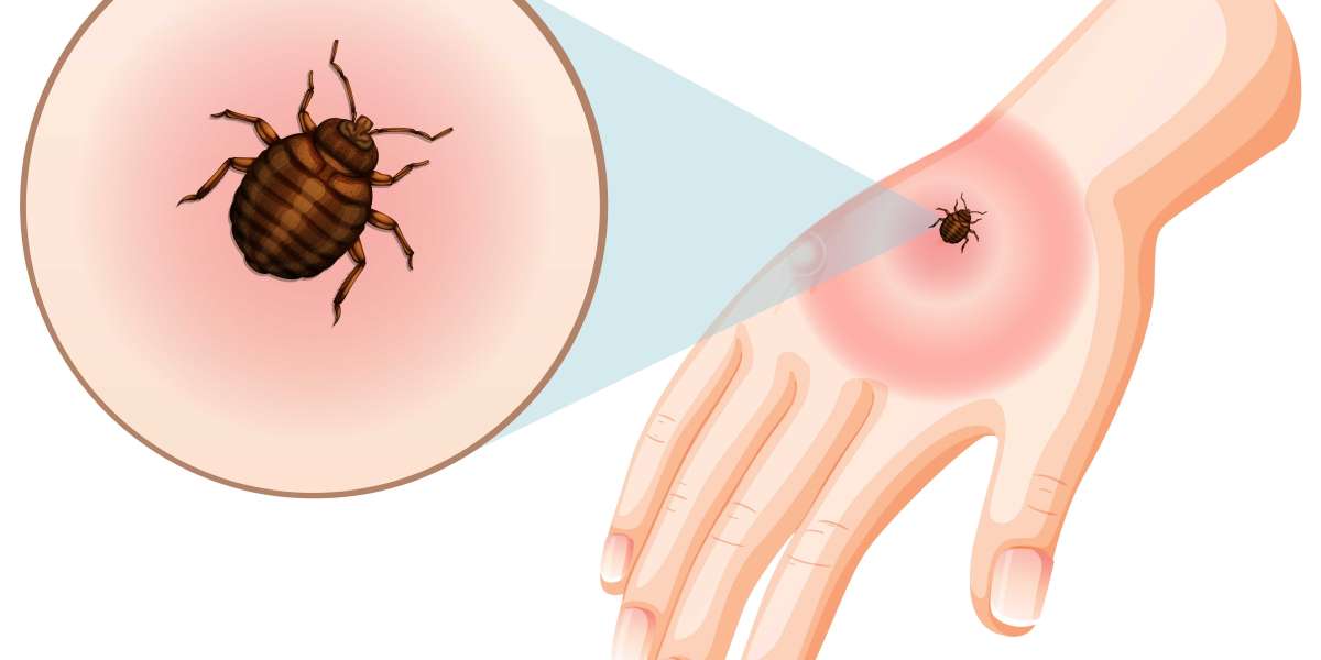 Understanding Lyme Disease: Top Strategies for Symptom Management and Relief