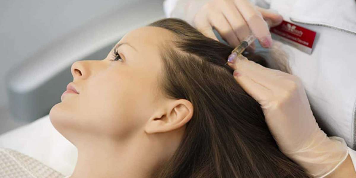 PRP Hair Treatment in Islamabad: What the Research Says